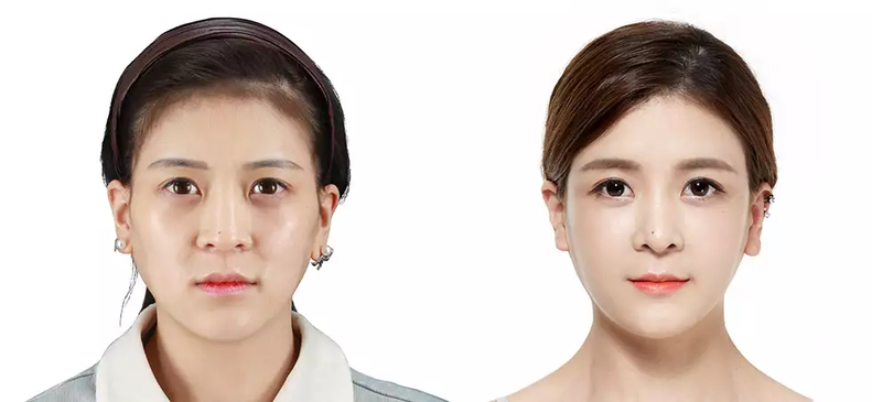 Slider image (2) JK Plastic Surgery 